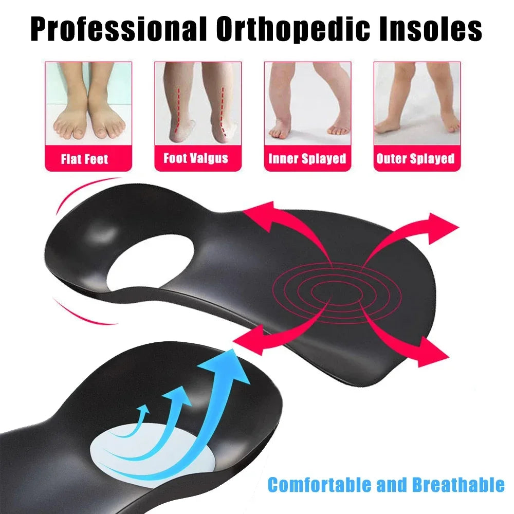 For Shoes Women Men XO-Legs Corrector Orthotic Insoles for Plantar Fasciitis Pain Relief Therapy Flat Feet Arch Support Insoles