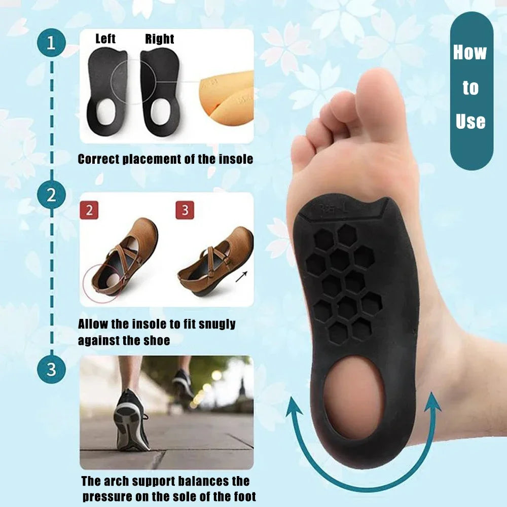 For Shoes Women Men XO-Legs Corrector Orthotic Insoles for Plantar Fasciitis Pain Relief Therapy Flat Feet Arch Support Insoles