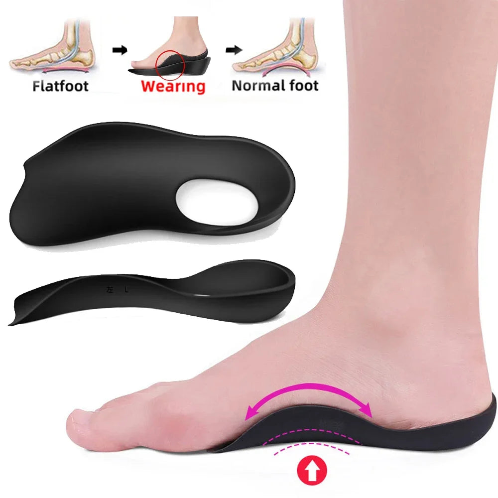 For Shoes Women Men XO-Legs Corrector Orthotic Insoles for Plantar Fasciitis Pain Relief Therapy Flat Feet Arch Support Insoles
